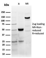 CD40/TNFRSF5/CD40L-Receptor Antibody in SDS-PAGE (SDS-PAGE)