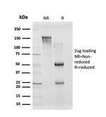 CREB5/CRE-BPa Antibody in SDS-PAGE (SDS-PAGE)