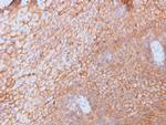 CD40 Ligand/CD154/TRAP1 (Activation Marker of T-Lymphocytes) Antibody in Immunohistochemistry (Paraffin) (IHC (P))