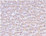 CD40 Ligand/CD154/TRAP1 (Activation Marker of T-Lymphocytes) Antibody in Immunohistochemistry (Paraffin) (IHC (P))