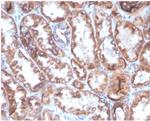 CD40 Ligand/CD154/TRAP1 (Activation Marker of T-Lymphocytes) Antibody in Immunohistochemistry (Paraffin) (IHC (P))