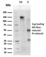 CD40 Ligand/CD154/TRAP1 (Activation Marker of T-Lymphocytes) Antibody in SDS-PAGE (SDS-PAGE)