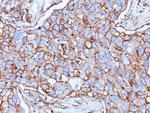 CD44/HCAM Std (Cancer Stem Cell Marker) Antibody in Immunohistochemistry (Paraffin) (IHC (P))