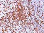 CD44/HCAM Std (Cancer Stem Cell Marker) Antibody in Immunohistochemistry (Paraffin) (IHC (P))