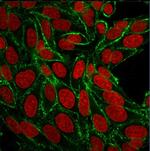 CD44/HCAM Std (Cancer Stem Cell Marker) Antibody in Immunocytochemistry (ICC/IF)