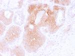 CD44v6 (Marker of Tumor Metastasis) Monoclonal Antibody (2F10)
