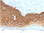 CD44v3 (Marker of Tumor Metastasis) Antibody in Immunohistochemistry (Paraffin) (IHC (P))
