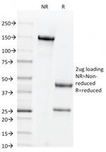 CD44v3 (Marker of Tumor Metastasis) Antibody in SDS-PAGE (SDS-PAGE)