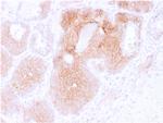 CD44v6 Monoclonal Antibody (CD44V6, 2496)