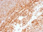 CD44/HCAM Std Antibody in Immunohistochemistry (Paraffin) (IHC (P))