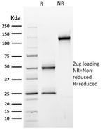 CD44/HCAM Std Antibody in SDS-PAGE (SDS-PAGE)