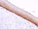 CD44v4/5 (Marker of Tumor Metastasis) Monoclonal Antibody (3D2)