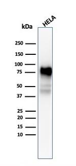 CD44/HCAM Std Antibody in Western Blot (WB)