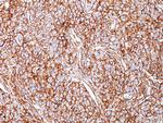CD44/HCAM Std Antibody in Immunohistochemistry (Paraffin) (IHC (P))