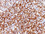 CD44/HCAM Std (Cancer Stem Cell Marker) Antibody in Immunohistochemistry (Paraffin) (IHC (P))