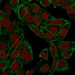 CD44/HCAM Std (Cancer Stem Cell Marker) Antibody in Immunocytochemistry (ICC/IF)