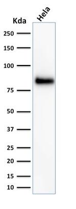 CD44/HCAM Std (Cancer Stem Cell Marker) Antibody in Western Blot (WB)