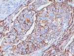 CD44/HCAM Std Antibody in Immunohistochemistry (Paraffin) (IHC (P))
