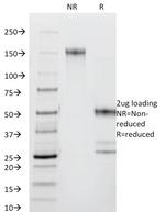 CD44/HCAM Std Antibody in SDS-PAGE (SDS-PAGE)