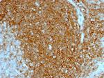 CD44/HCAM Std Antibody in Immunohistochemistry (Paraffin) (IHC (P))