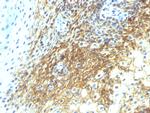 CD44v4 Antibody in Immunohistochemistry (Paraffin) (IHC (P))