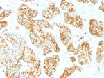 CD44v9 (Marker of Tumor Metastasis) Antibody in Immunohistochemistry (Paraffin) (IHC (P))