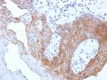 CD44v9 (Marker of Tumor Metastasis) Antibody in Immunohistochemistry (Paraffin) (IHC (P))