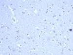 CD44/HCAM Std (Cancer Stem Cell Marker) Antibody in Immunohistochemistry (Paraffin) (IHC (P))