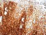 CD44/HCAM Std (Cancer Stem Cell Marker) Antibody in Immunohistochemistry (Paraffin) (IHC (P))