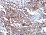 CD44/HCAM Std (Cancer Stem Cell Marker) Antibody in Immunohistochemistry (Paraffin) (IHC (P))
