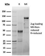 CD44/HCAM Std (Cancer Stem Cell Marker) Antibody in SDS-PAGE (SDS-PAGE)