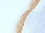 CD44v9 Recombinant Rabbit Monoclonal Antibody (CD44v9, 2344R)