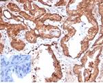CD47/IAP (Integrin Associated Protein) Antibody in Immunohistochemistry (Paraffin) (IHC (P))