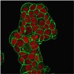 CD47/IAP (Integrin Associated Protein) Antibody in Immunocytochemistry (ICC/IF)