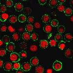 CD47/IAP (Integrin Associated Protein) Antibody in Immunocytochemistry (ICC/IF)