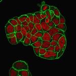 CD47/IAP (Integrin Associated Protein) Antibody in Immunocytochemistry (ICC/IF)