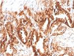 CD47/IAP (Integrin Associated Protein) Antibody in Immunohistochemistry (Paraffin) (IHC (P))