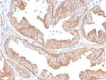 CD47/IAP (Integrin Associated Protein) Antibody in Immunohistochemistry (Paraffin) (IHC (P))