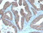 CD47/IAP (Integrin Associated Protein) Antibody in Immunohistochemistry (Paraffin) (IHC (P))