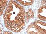 CD47/IAP (Integrin Associated Protein) Antibody in Immunohistochemistry (Paraffin) (IHC (P))