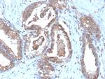 CD47/IAP (Integrin Associated Protein) Antibody in Immunohistochemistry (Paraffin) (IHC (P))