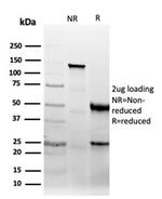 CD47/IAP (Integrin Associated Protein) Antibody in SDS-PAGE (SDS-PAGE)