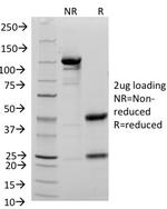 CD48 (Pan Leukocyte Marker) Antibody in SDS-PAGE (SDS-PAGE)
