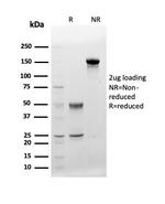CD48 (Pan Leukocyte Marker) Antibody in SDS-PAGE (SDS-PAGE)