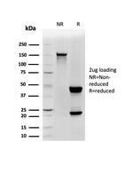 CD48 (Pan Leukocyte Marker) Antibody in SDS-PAGE (SDS-PAGE)
