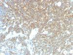 CD48 (Pan Leukocyte Marker) Monoclonal Antibody (CD48/4785)
