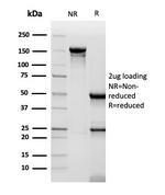 CD48 (Pan Leukocyte Marker) Antibody in SDS-PAGE (SDS-PAGE)