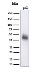 CD48 (Pan Leukocyte Marker) Antibody in Western Blot (WB)