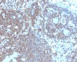 CD48 (Pan Leukocyte Marker) Antibody in Immunohistochemistry (Paraffin) (IHC (P))