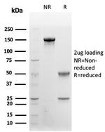 CD48 (Pan Leukocyte Marker) Antibody in SDS-PAGE (SDS-PAGE)